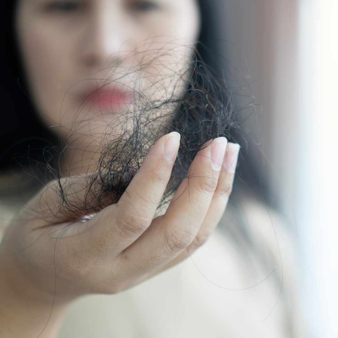 Hvorfor fælder jeg så meget ?